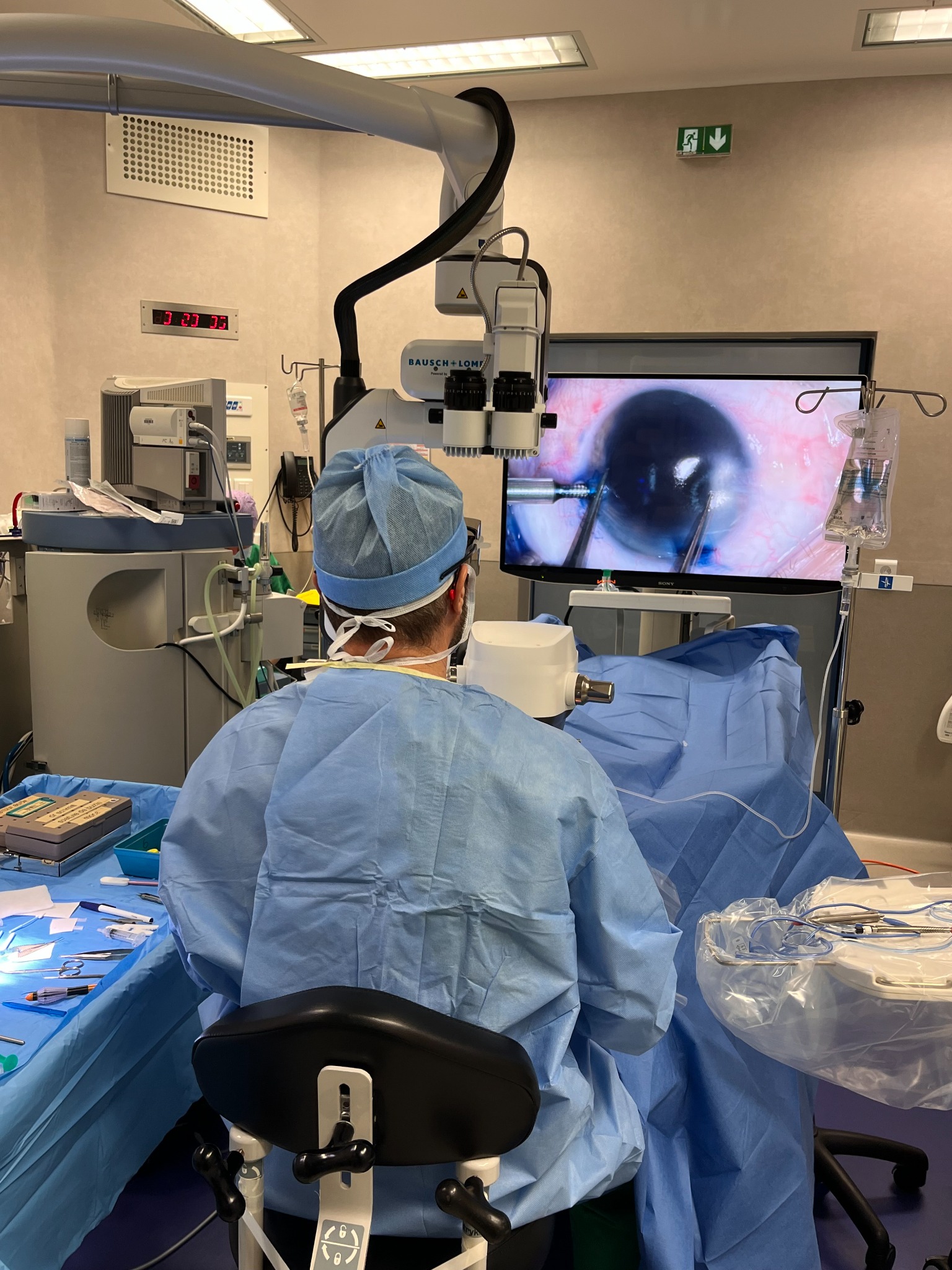 Intervention de chirurgie cornéenne au bloc opératoire ophtalmologique